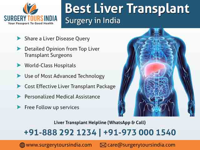 Liver Transplant Treatment in India