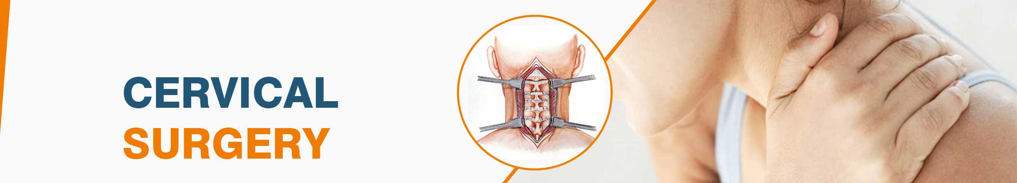 Cervical Surgery in India