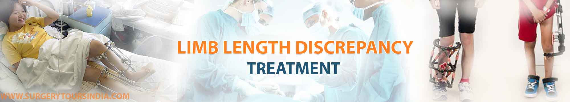 Treatment Options for Limb Length Discrepancy