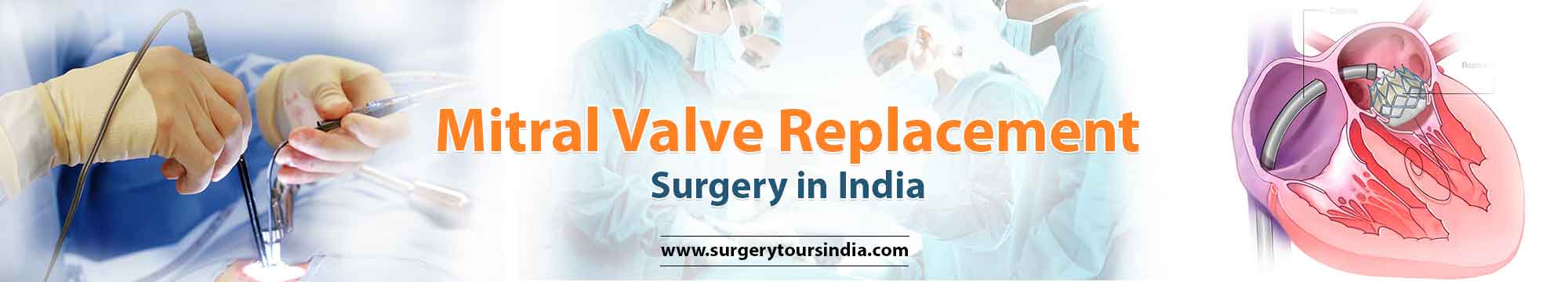 Mitral Valve Replacement Surgery