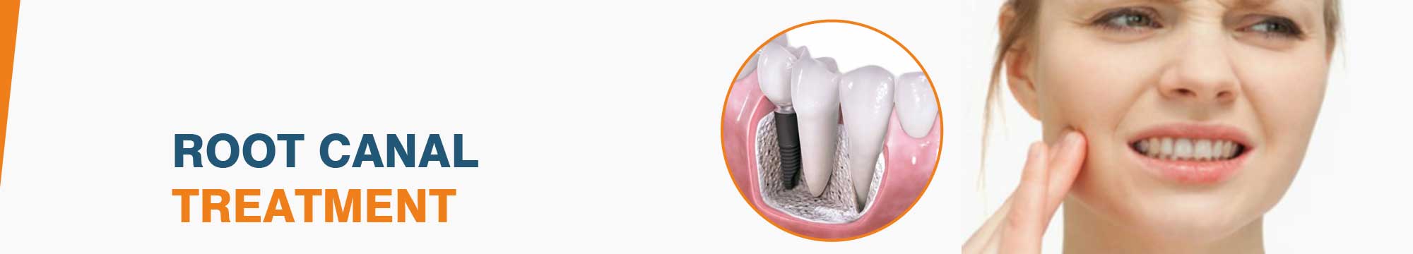 Affordable Root Canal Treatment In India