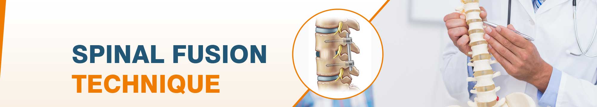 , Spinal Fusion Surgery Cost in India