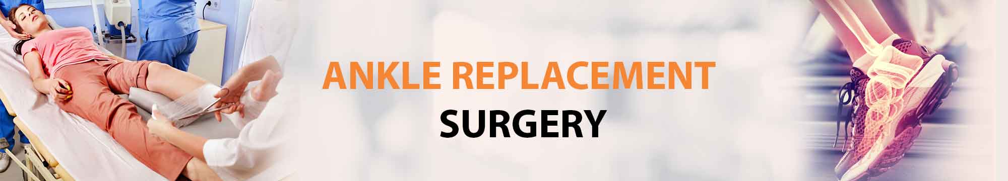 Guide to Ankle Replacement Surgery