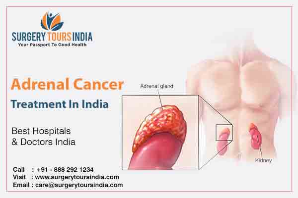 Adrenal Cancer Treatment India