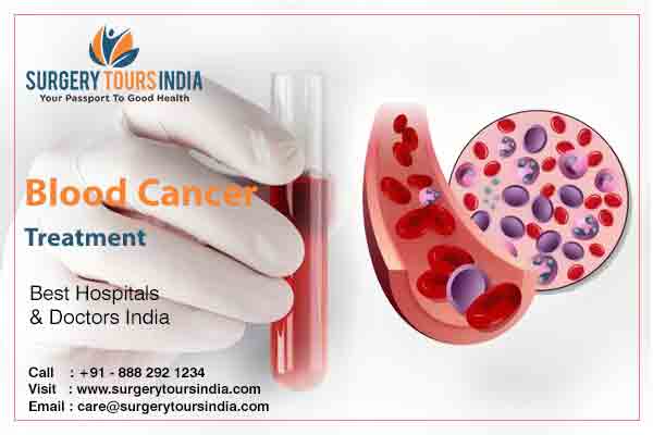 Blood Cancer Treatment In India