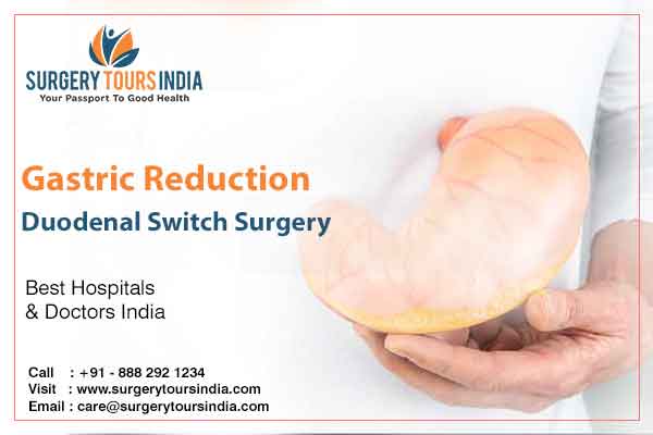 Gastric Reduction Duodenal Switch Surgery