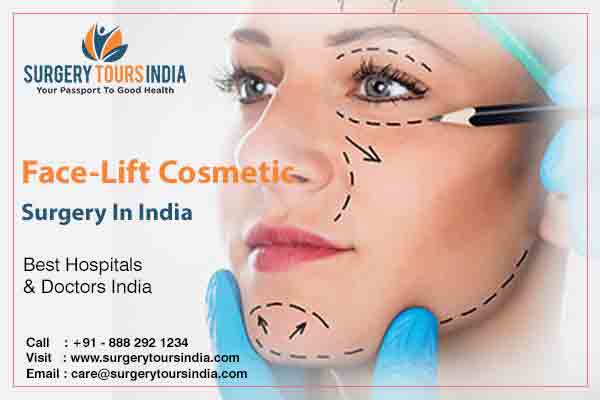 Face-Lift Cosmetic Surgery