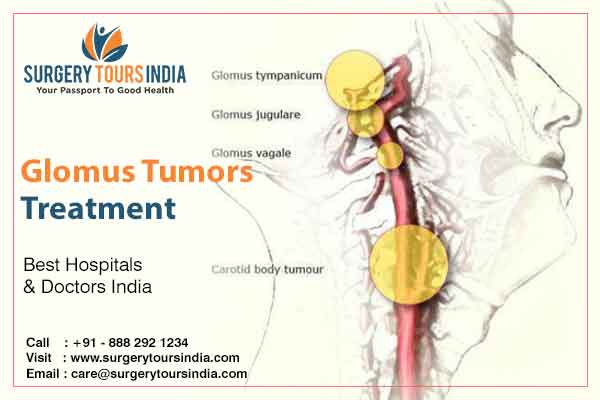 Glomus Tumors Treatment in India