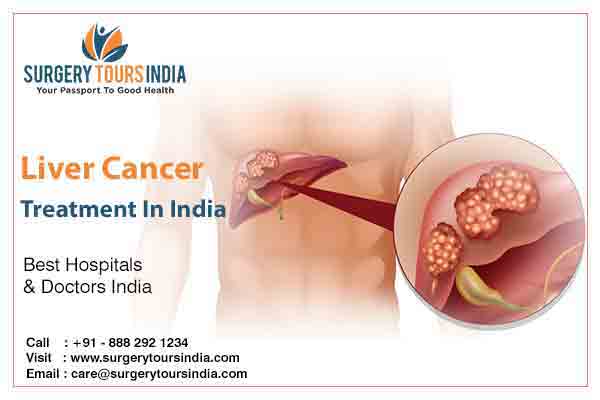 Liver Cancer Treatment India