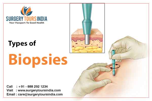 What is Biopsy