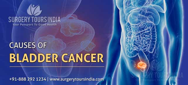 causes of bladder cancer