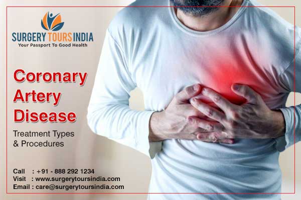 Coronary Artery Disease Treatment