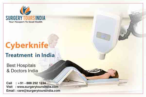 COST Cyberknife Treatment in India