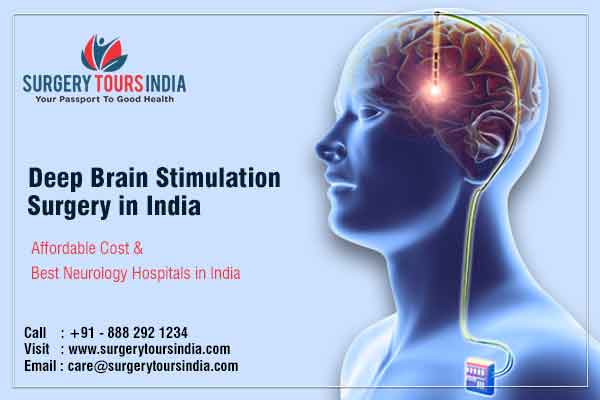 Deep Brain Stimulation Surgery in India