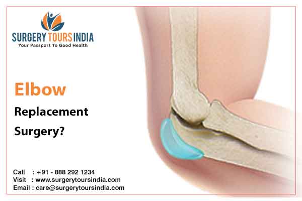 Elbow Replacement Surgery