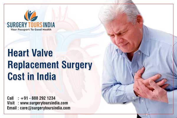 Heart Valve Replacement Surgery in India