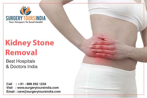 kidney stone removal surgery cost in india
