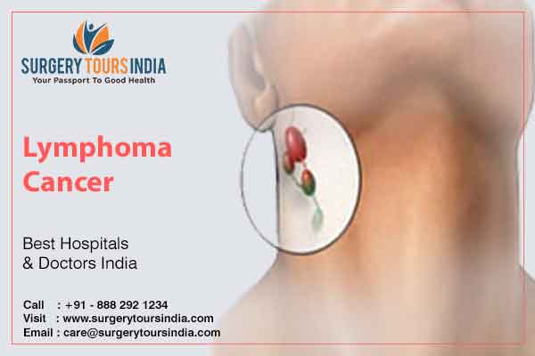 Lymphoma Cancer Treatment in India
