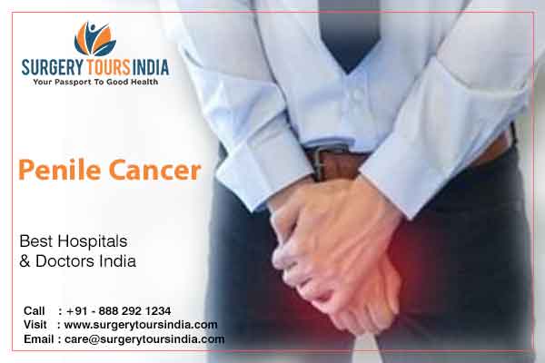 Penile Cancer Treatment In India