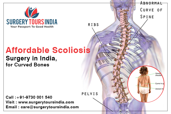 Scoliosis surgery in India