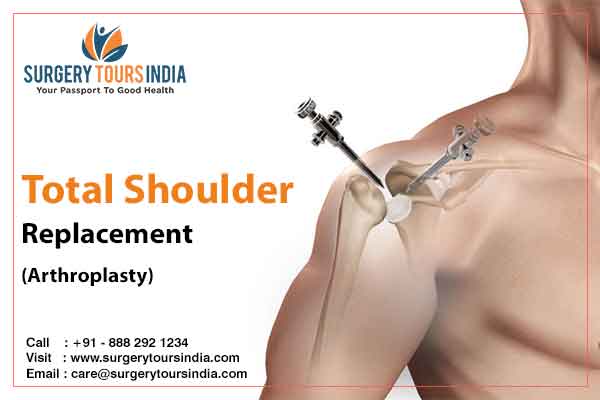 Shoulder replacement surgery cost in india